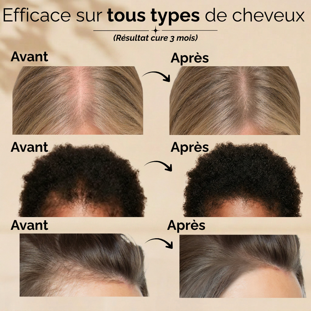 Le sérum capillaire N°1 en Corée - 100 ml